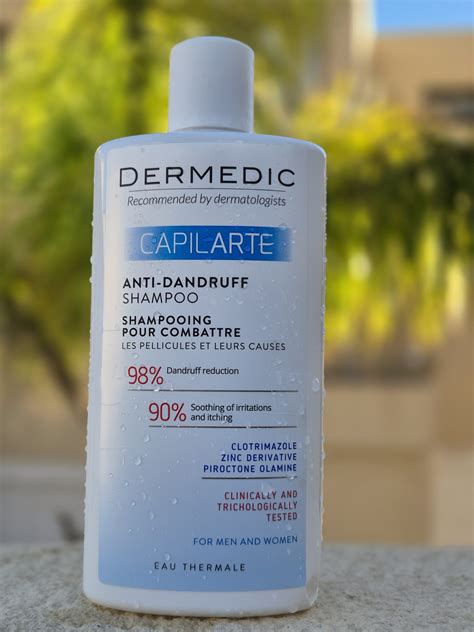 Infografika, iliustruojanti skirtingus plaukų slinkimo tipus ir jų požymius