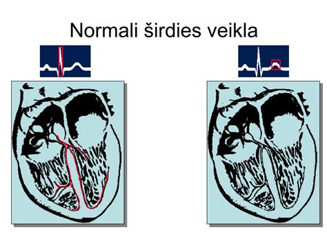 Širdies elektrinės sistemos (sinusinio mazgo, AV mazgo, laidumo takų) iliustracija