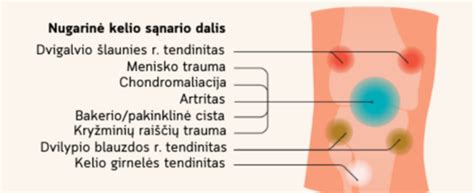 schema, vaizduojanti ksenoninių žibintų spindulio reguliavimą važiuojant kairiąja/dešiniąja kelio puse