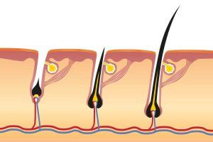 Scheminė plaukų augimo fazių iliustracija