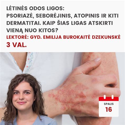 infografika: kaip vizualiai atskirti sveiką saugiklį nuo perdegusio