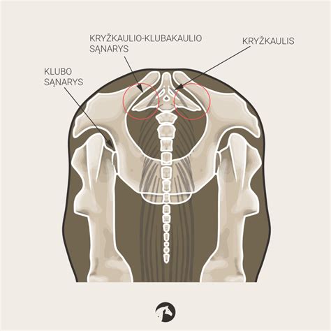 infografika su kryžkaulinio klubakaulio sąnario provokacijos testų atlikimo schemomis