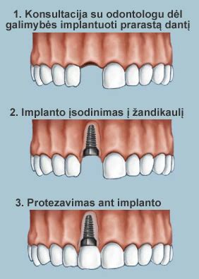 Infografika: Baudų įsakymo procesas - nuo išdavimo iki galutinio sprendimo