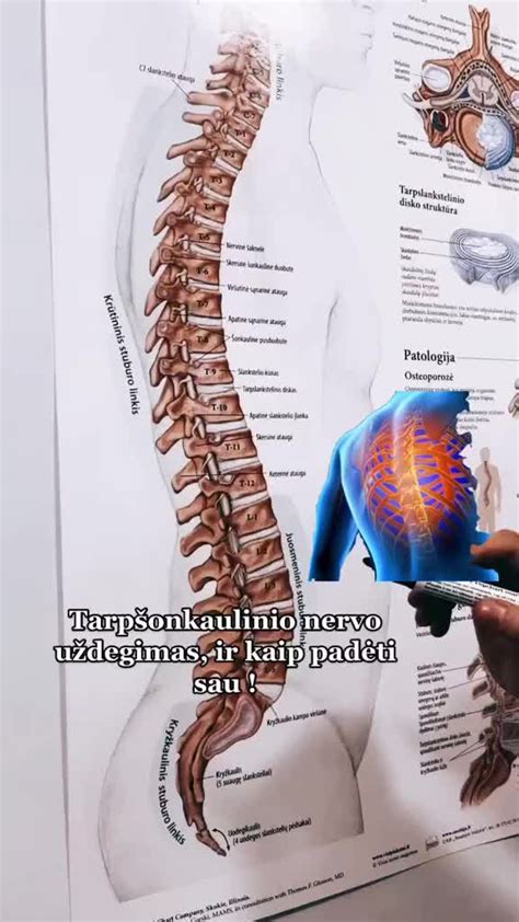Infografika: tarpšonkaulinės neuralgijos diagnostikos srautas