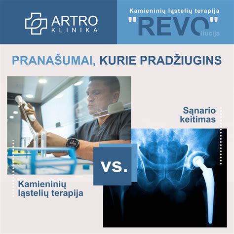 infografika, iliustruojanti dirbtinio sąnario komponentų išdėstymą