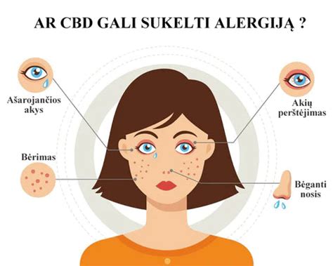 Infografika apie alerginių reakcijų simptomus