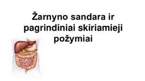 schema: šoninio veidrodėlio sandara ir pagrindiniai tvirtinimo taškai, kuriuos reikia atjungti ardymo metu